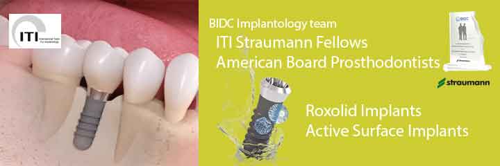 Tooth Implant Center