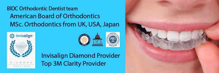 braces orthodontic center