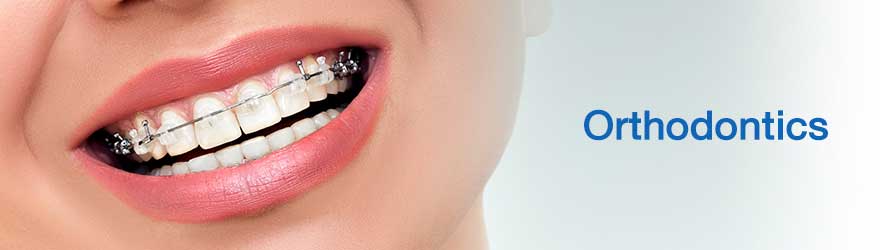 orthodontic dental fees