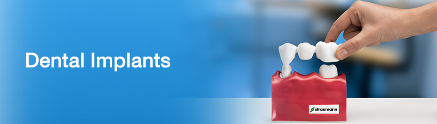 dental implants fees