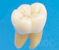wisdom tooth