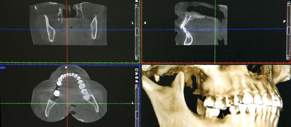 เทคโนโลยี CT Scan