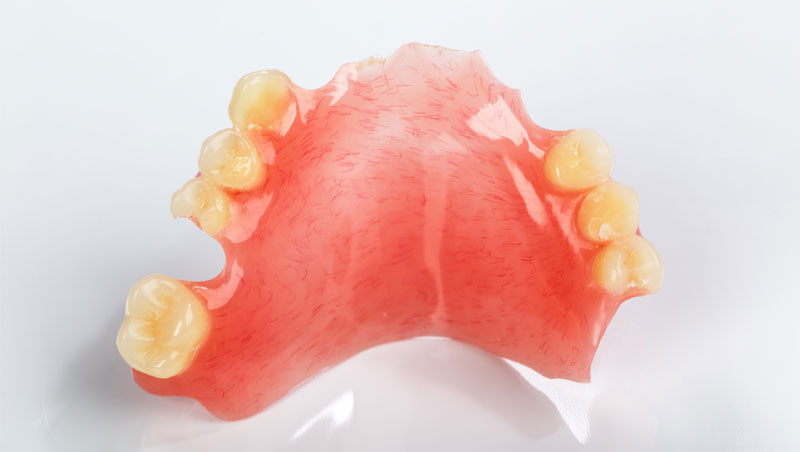 Partial Denture