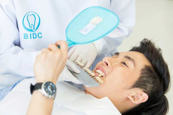 teeth whitening fees
