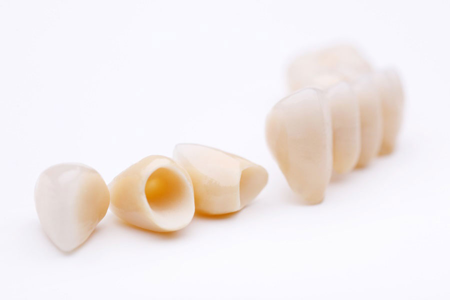 cercon dental crowns fees