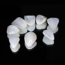 เคลือบผิวฟันวีเนียร์