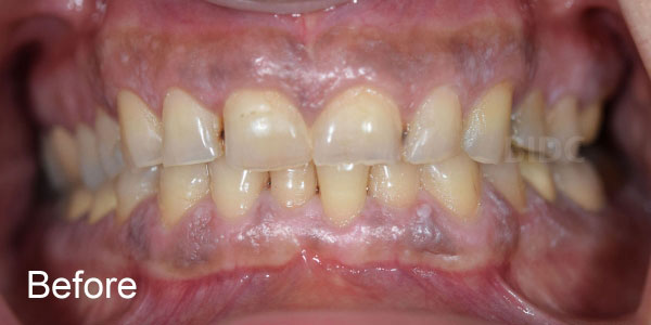 Aesthetics Dental Makeovers