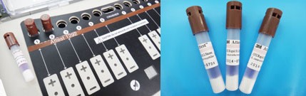 Biological Testing for Total Sterilization