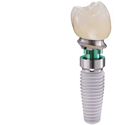 Tooth implant parts