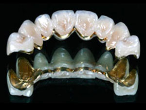 All Gold bridge