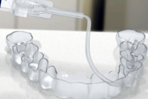 At home whitening kit