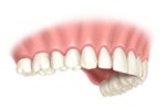 full tooth