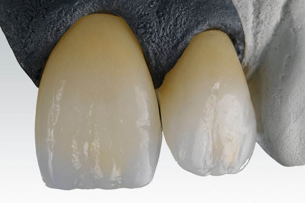 Zirconia Dental Crowns