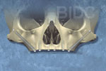 zygoma dental implants