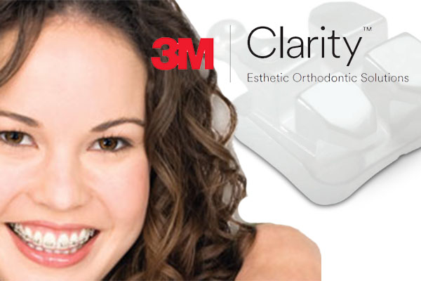 clarity braces