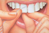 proper flossing dental technique