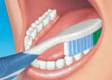 dental clinic teeth cleaning