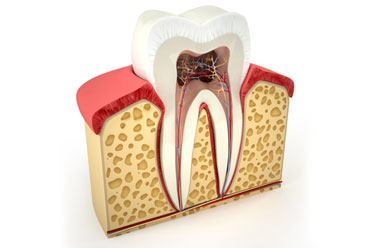 root canal treatment