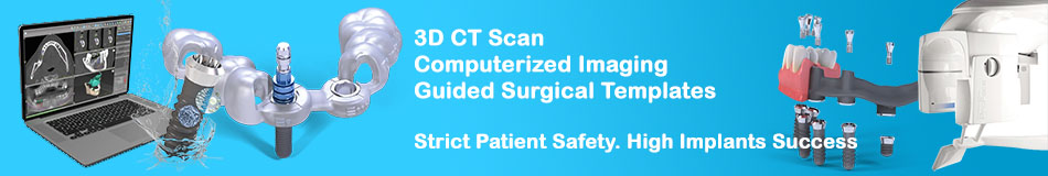 technology dental implants price