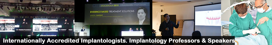 dentists implants fees