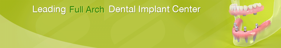 dental implants fees