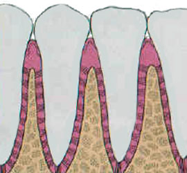 gums treatments