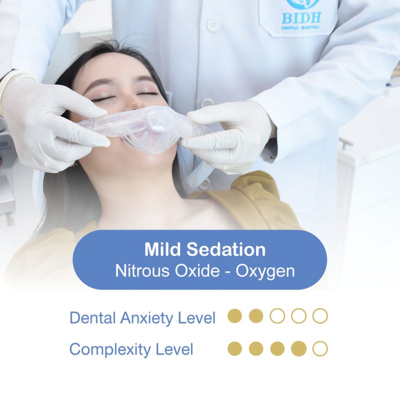 laughing gas sedation