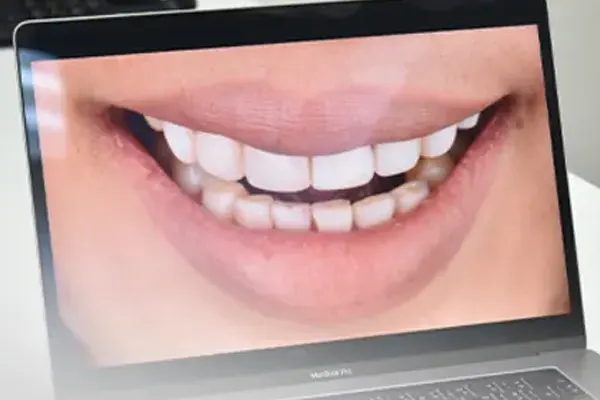 Advance Techniques Personalized Your Smile