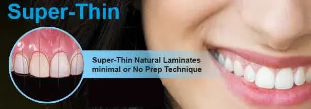 Dental Veneers clinic