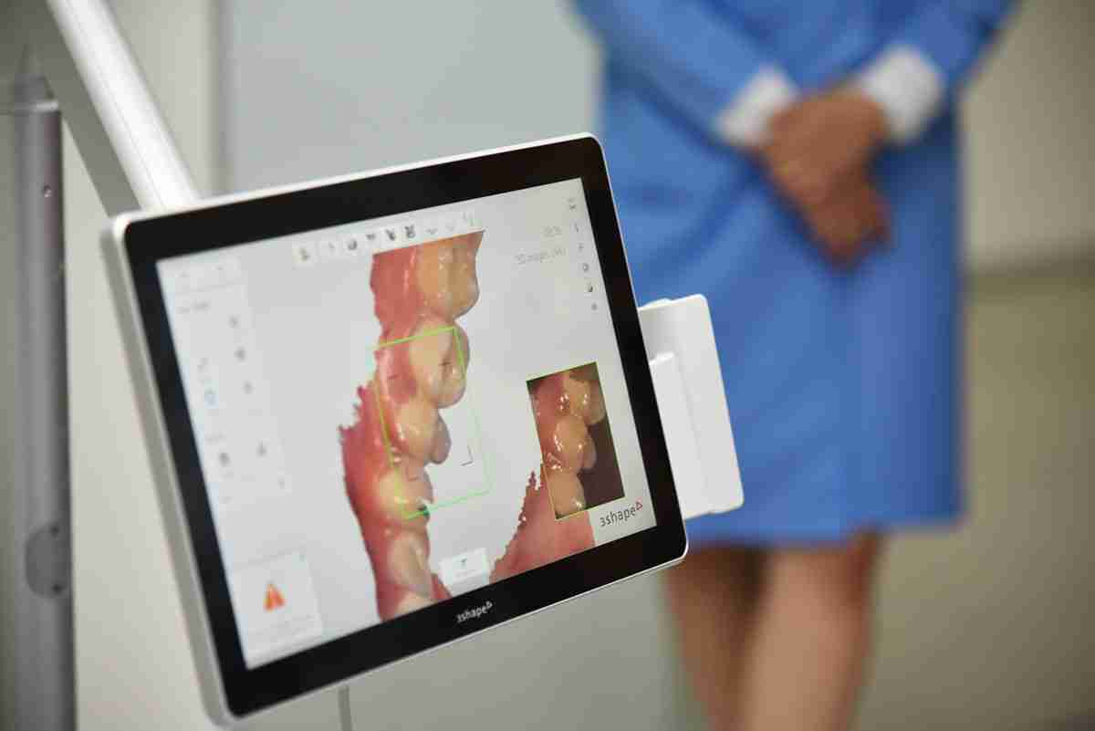 digital scan dentistry